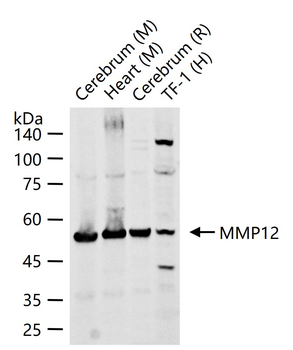 MMP12 Rabbit Polyclonal Antibody