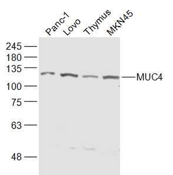 MUC4 Rabbit Polyclonal Antibody