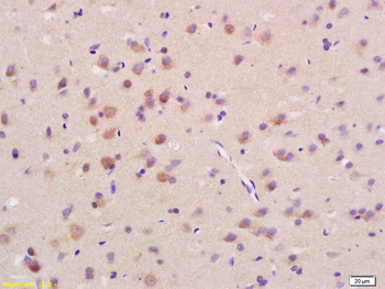 CHRNA2 (neuronal) Rabbit Polyclonal Antibody