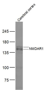 NMDAR1 Rabbit Polyclonal Antibody