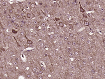 GLUR4 Rabbit Polyclonal Antibody