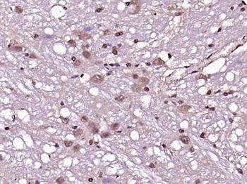 PAK5 Rabbit Polyclonal Antibody
