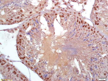 Parkin Rabbit Polyclonal Antibody