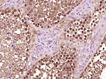SPDEF Rabbit Polyclonal Antibody