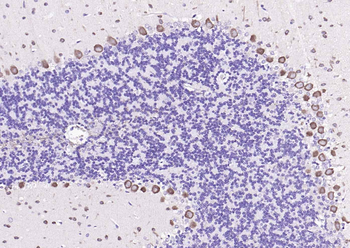 Pleiotrophin Rabbit Polyclonal Antibody