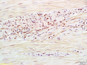 RNF126 Rabbit Polyclonal Antibody