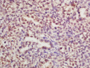 RPLP0 Rabbit Polyclonal Antibody
