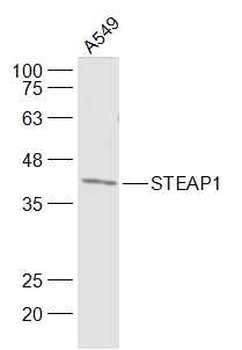 STEAP1 Rabbit Polyclonal Antibody