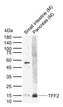 TFF2 Rabbit Polyclonal Antibody