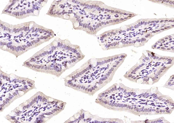 TNFAIP1 Rabbit Polyclonal Antibody