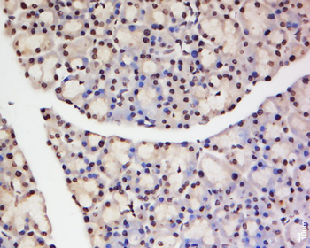 TNFAIP1 Rabbit Polyclonal Antibody
