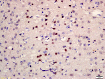 Telomerase Binding Protein, P23 Rabbit Polyclonal Antibody