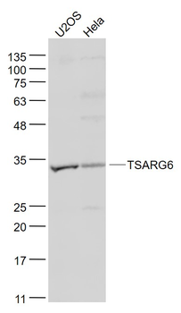 TSARG6 Rabbit Polyclonal Antibody