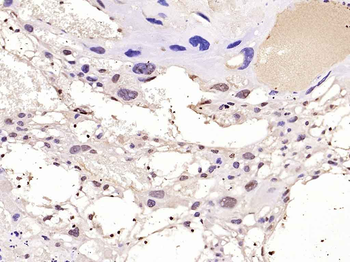 TWIST Rabbit Polyclonal Antibody