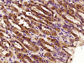 LAMP1 Rabbit Polyclonal Antibody