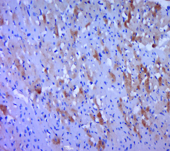 WNT2B Rabbit Polyclonal Antibody
