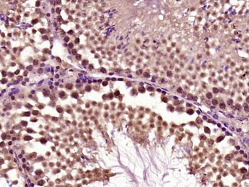 Zfp91 Rabbit Polyclonal Antibody