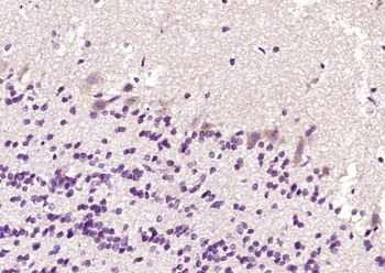 Phospholipase C beta 1 Rabbit Polyclonal Antibody