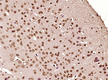 AKIRIN2 Rabbit Polyclonal Antibody