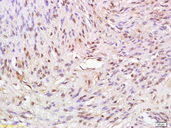 ATAD2 Rabbit Polyclonal Antibody