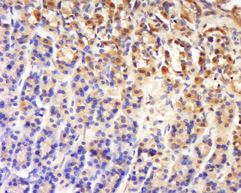LRCH4/LRRN1 Rabbit Polyclonal Antibody