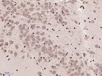 MARCH7 Rabbit Polyclonal Antibody
