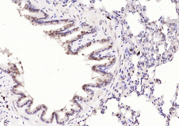 ACPL2 Rabbit Polyclonal Antibody
