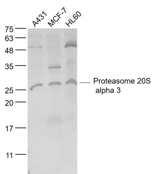 Proteasome 20S alpha 3 Rabbit Polyclonal Antibody