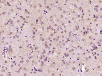 AHNAK2 Rabbit Polyclonal Antibody