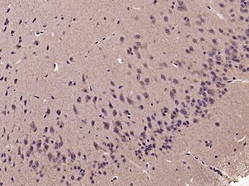 Proteasome 19S 10B Rabbit Polyclonal Antibody