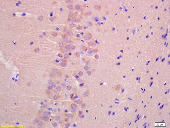 TTC33 Rabbit Polyclonal Antibody