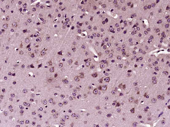 Phospho-STAT1 (Tyr701) Rabbit Polyclonal Antibody