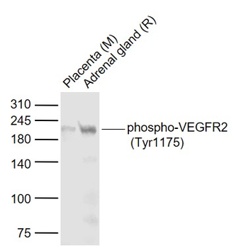 Phospho-VEGFR2 (Tyr1175) Rabbit Polyclonal Antibody
