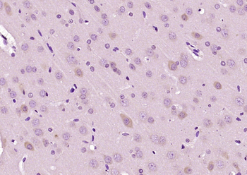 STIP1 Rabbit Polyclonal Antibody
