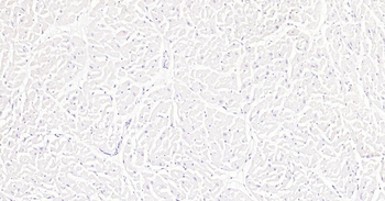 Ki67 Recombinant Rabbit Monoclonal Antibody