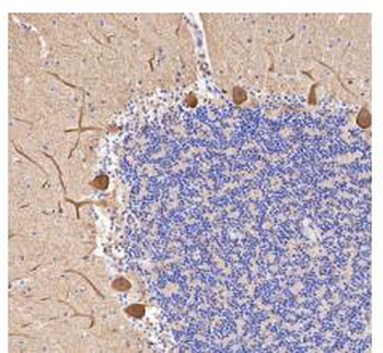 CALB1 Recombinant Rabbit Monoclonal Antibody