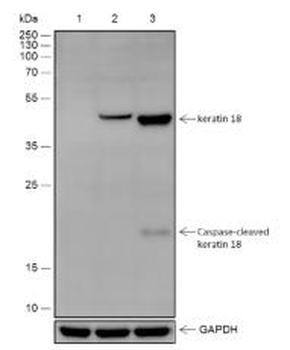CK18 Recombinant Rabbit Monoclonal Antibody