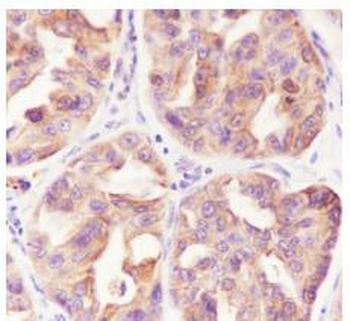 CK18 Recombinant Rabbit Monoclonal Antibody
