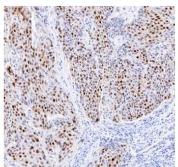 P21 Recombinant Rabbit Monoclonal Antibody