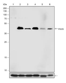 PAX5 Recombinant Rabbit Monoclonal Antibody