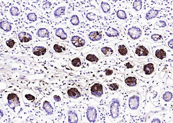 Lysozyme Recombinant Rabbit Monoclonal Antibody