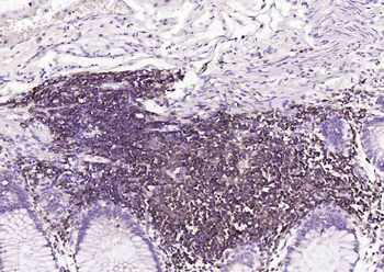 CD20 Recombinant Rabbit Monoclonal Antibody