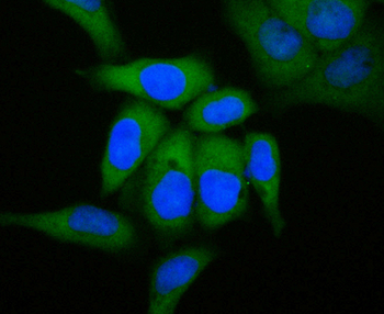 GCDFP15 Recombinant Rabbit Monoclonal Antibody
