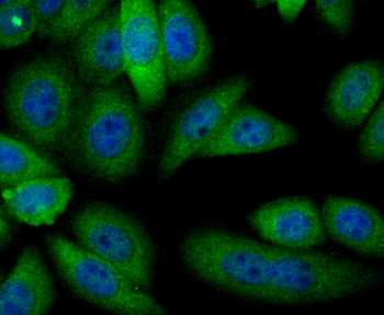ADH1A Recombinant Rabbit Monoclonal Antibody