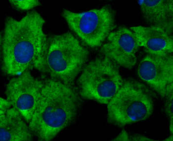 Growth hormone receptor Recombinant Rabbit Monoclonal Antibody