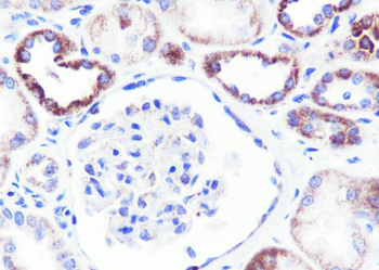 GBA Recombinant Rabbit Monoclonal Antibody