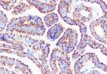 GBA Recombinant Rabbit Monoclonal Antibody