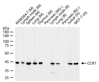 CCR7 Recombinant Rabbit Monoclonal Antibody