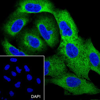 Hsp27 Recombinant Rabbit Monoclonal Antibody