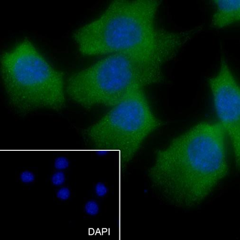 Hsp27 Recombinant Rabbit Monoclonal Antibody